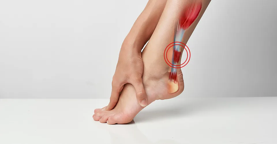 Tendinite de Aquiles