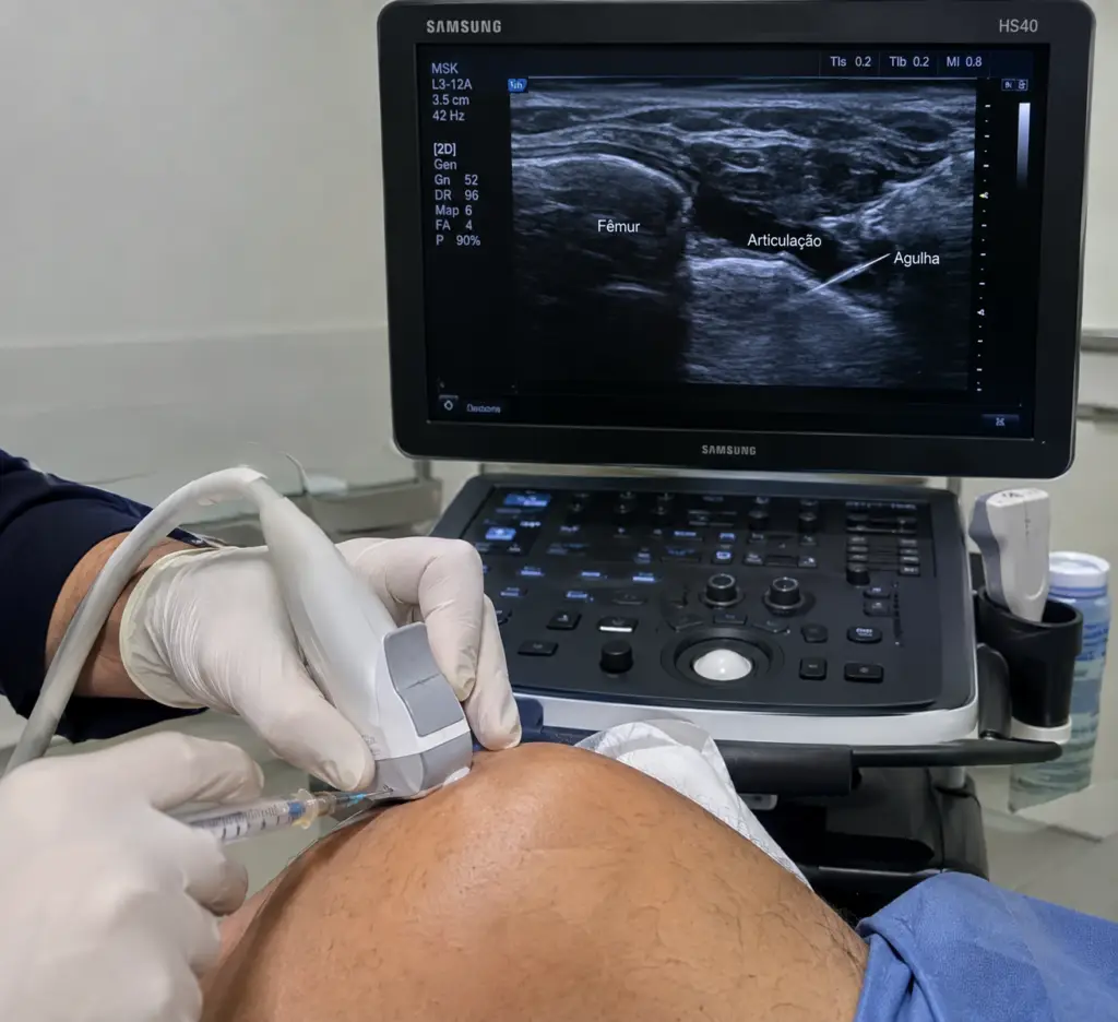 Infiltração guiada por ultrassom