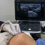 Infiltração guiada por ultrassom